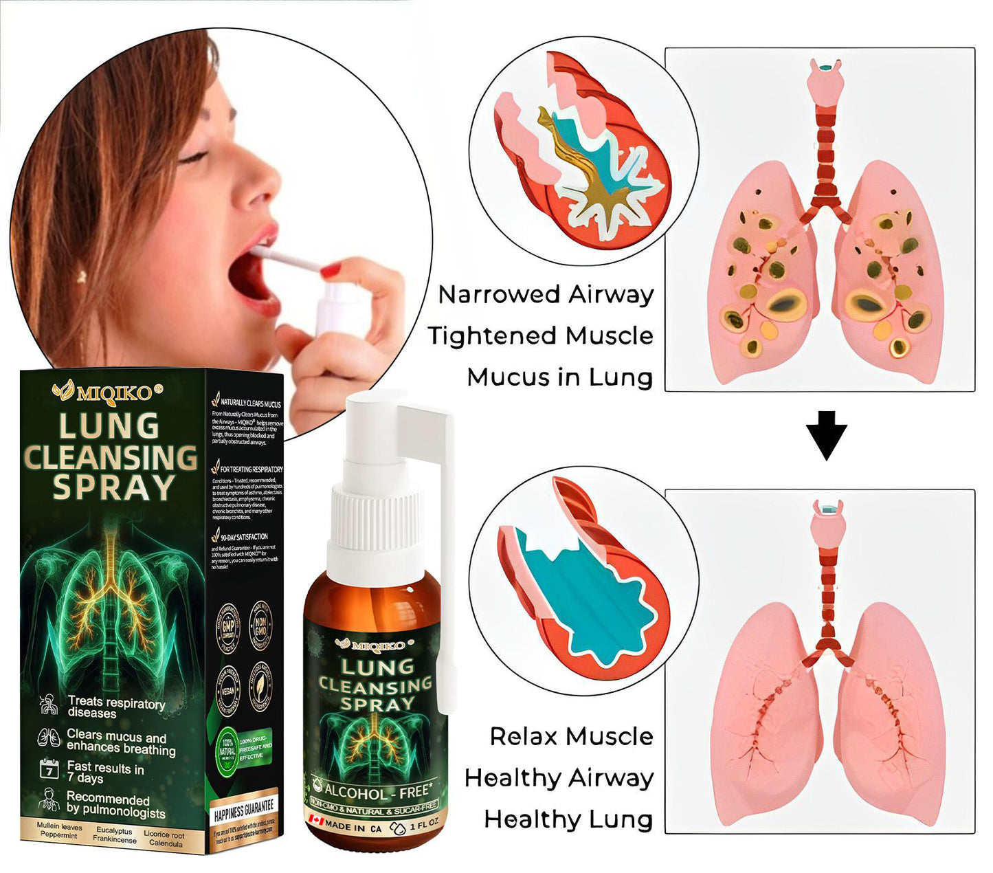 ✨MIQIKO® Advanced Lung Cleansing Spray (👨‍⚕️Recommended by Lung Specialists🫁)