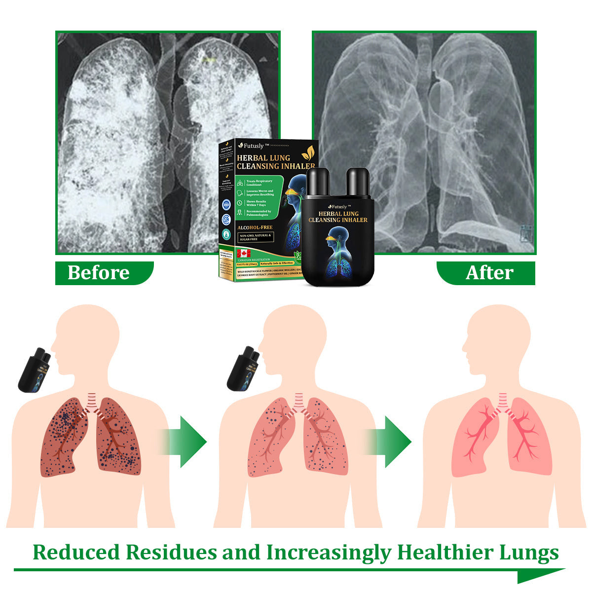 ✅Official Store: Futusly™ Herbal Lung Cleansing Inhaler (💝 Cough, wheezing, shortness of breath, sputum, stuffy nose, bronchitis, bronchitis, allergy symptoms, lung discomfort💝)